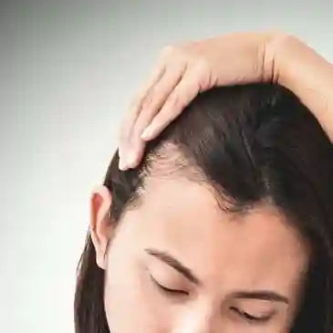 Hair Loss Treatment - PRP